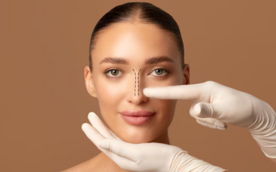 Comment les chirurgiens anticipent-ils le résultat d’une rhinoplastie à Lyon ?