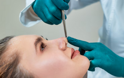 Rhinoplastie à Lyon : que faire si le résultat final ne correspond pas aux attentes ?