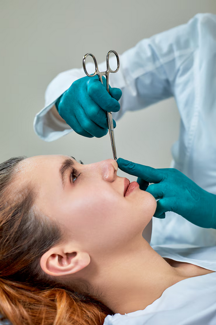 chirurgie de la cloison nasale Lyon