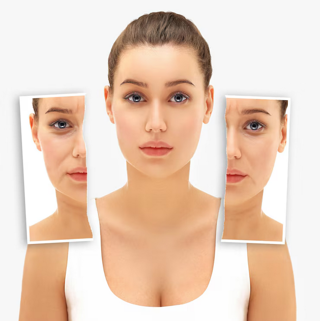 rhinoplastie à Lyon