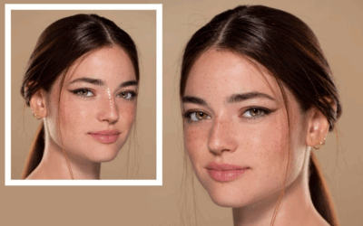 Quels sont les critères d’un bon résultat en rhinoplastie avant et après à Lyon ?