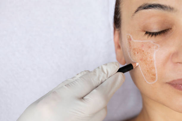 chirurgie cutanée et réparatrice du visage