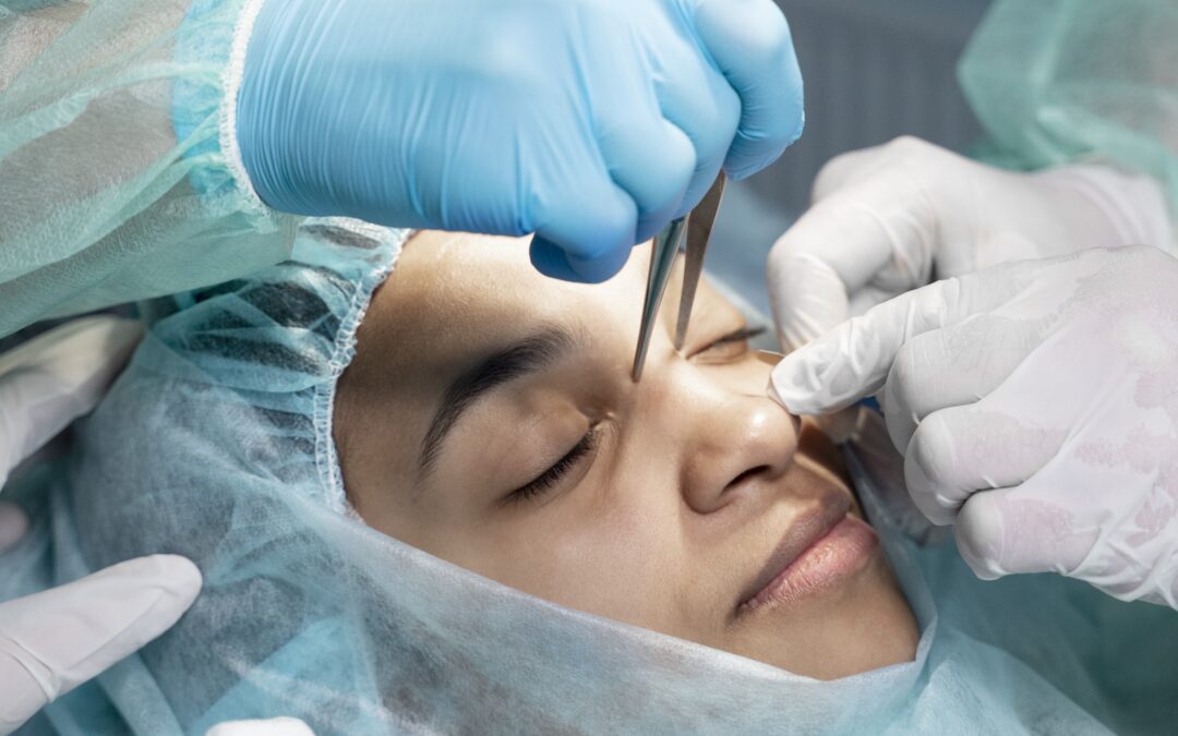 Rhinoplastie à Lyon