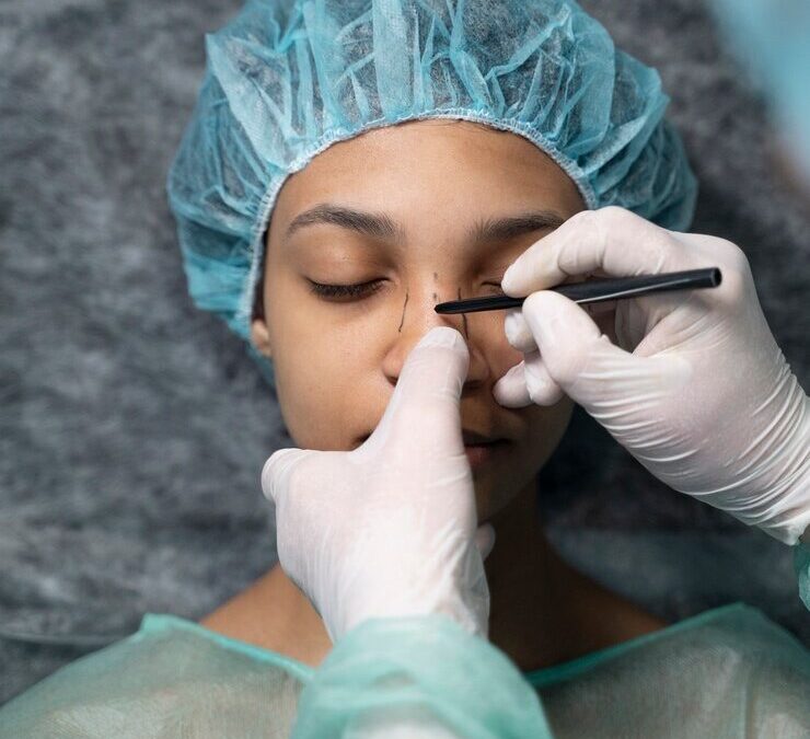 Rhinoplastie Lyon